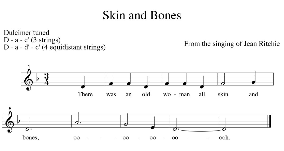 Skin and Bones tune notation